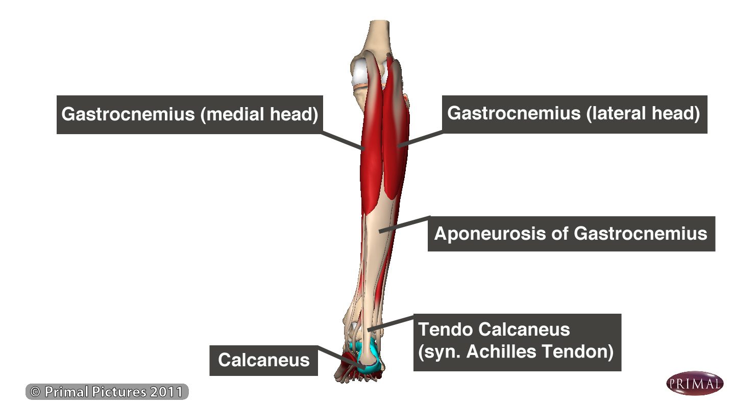 Calf Strain (Pulled Calf Muscle) treatment and symptoms – Vivomed