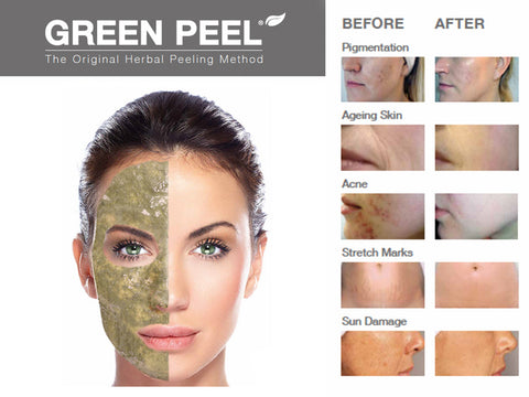 Green Peel Classic. Green Peel Fresh up. Green Peel Energy.