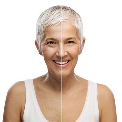 Before and after picture of middle aged woman from shoulders up, for our blog post on Gentle Face Skin Peel at Home.
