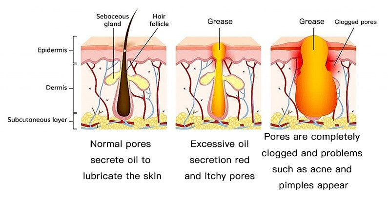 The Main Causes Of Skin Problems