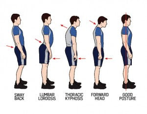 posture profile