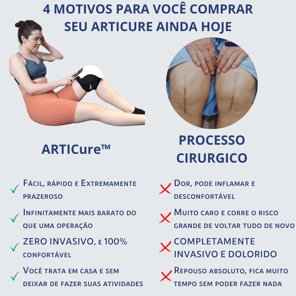 4 motivos para comprar o articure ao invés de cirurgia no joelho os pós e contras