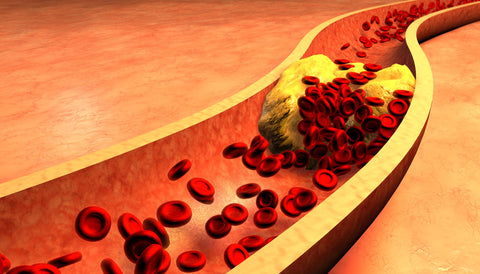 An illustration of a clogged artery with platelets and cholesterol plaque.