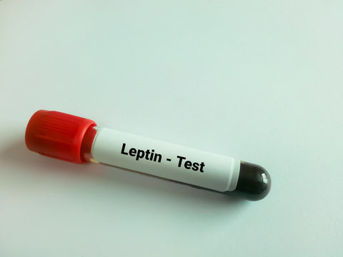 An image of a tube of blood with text that reads Leptin test.