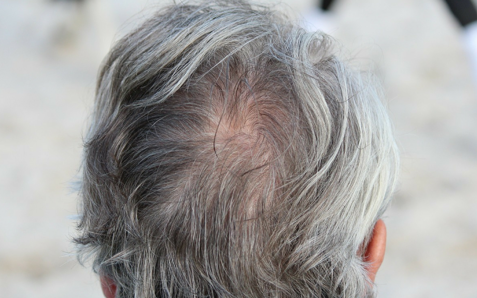 Scientists Discover What Causes Grey Hair