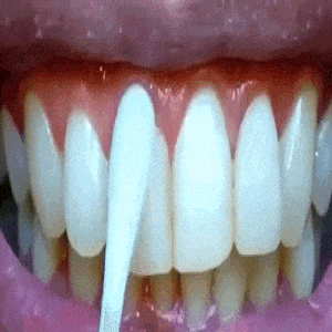 טיפות להלבנת שיניים ושמירה על היגיינת הפה