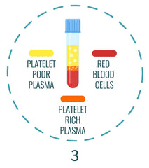 PRP 3