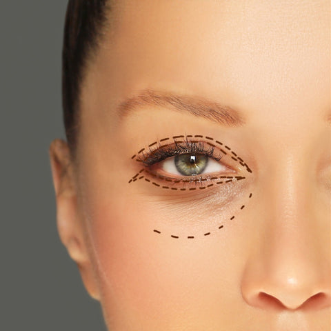 eyelid surgery