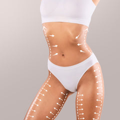 Liposuction