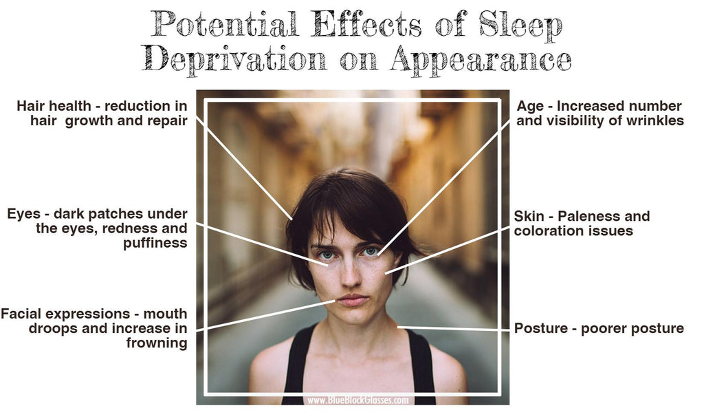 Impact of Sleep Deprivation on Appearance