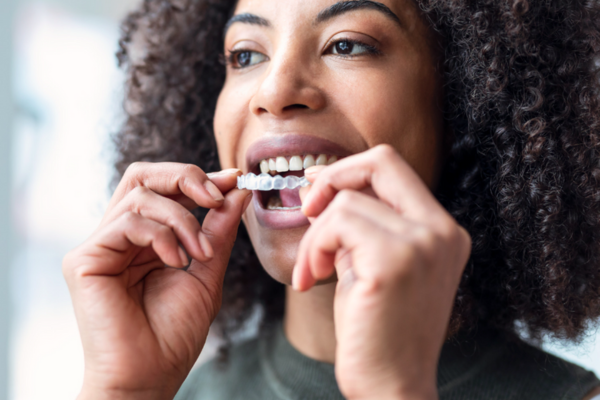 Woman putting on clear aligners