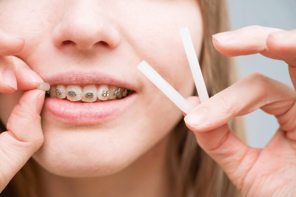  Woman with braces applying orthodontic wax