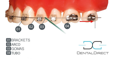 Arcos dentales | dentaldirect