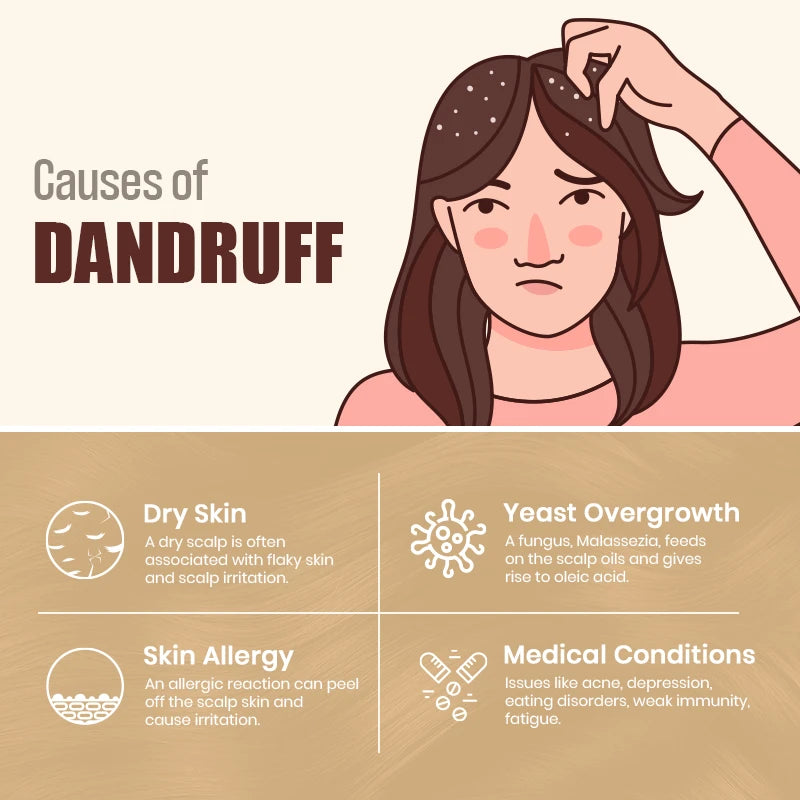 Causes_of_dandruff