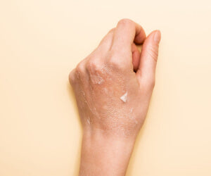 Exfoliating dry skin