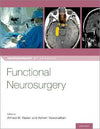 Functional Neurosurgery | ABC Books