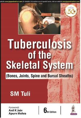 Tuberculosis of the Skeletal System (Bones, Joints, Spine and Bursal Sheaths), 6e