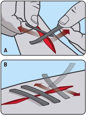 Duct Tape to Fix Wounds Survival Tip