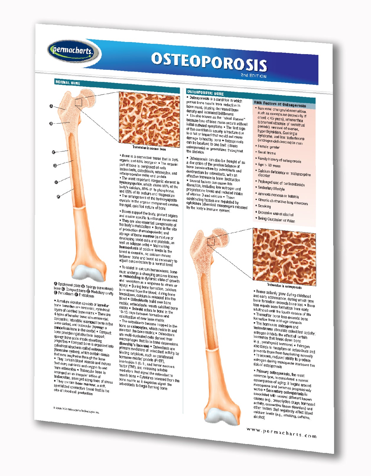 osteoporosis case study scribd