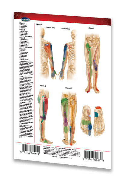 Trigger Points Chart - Extremities - Acupuncture Pocket Chart