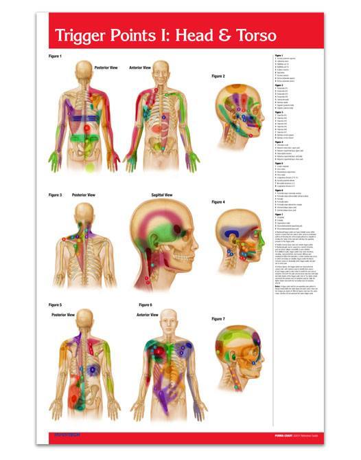 Trigger Point Charts For Sale