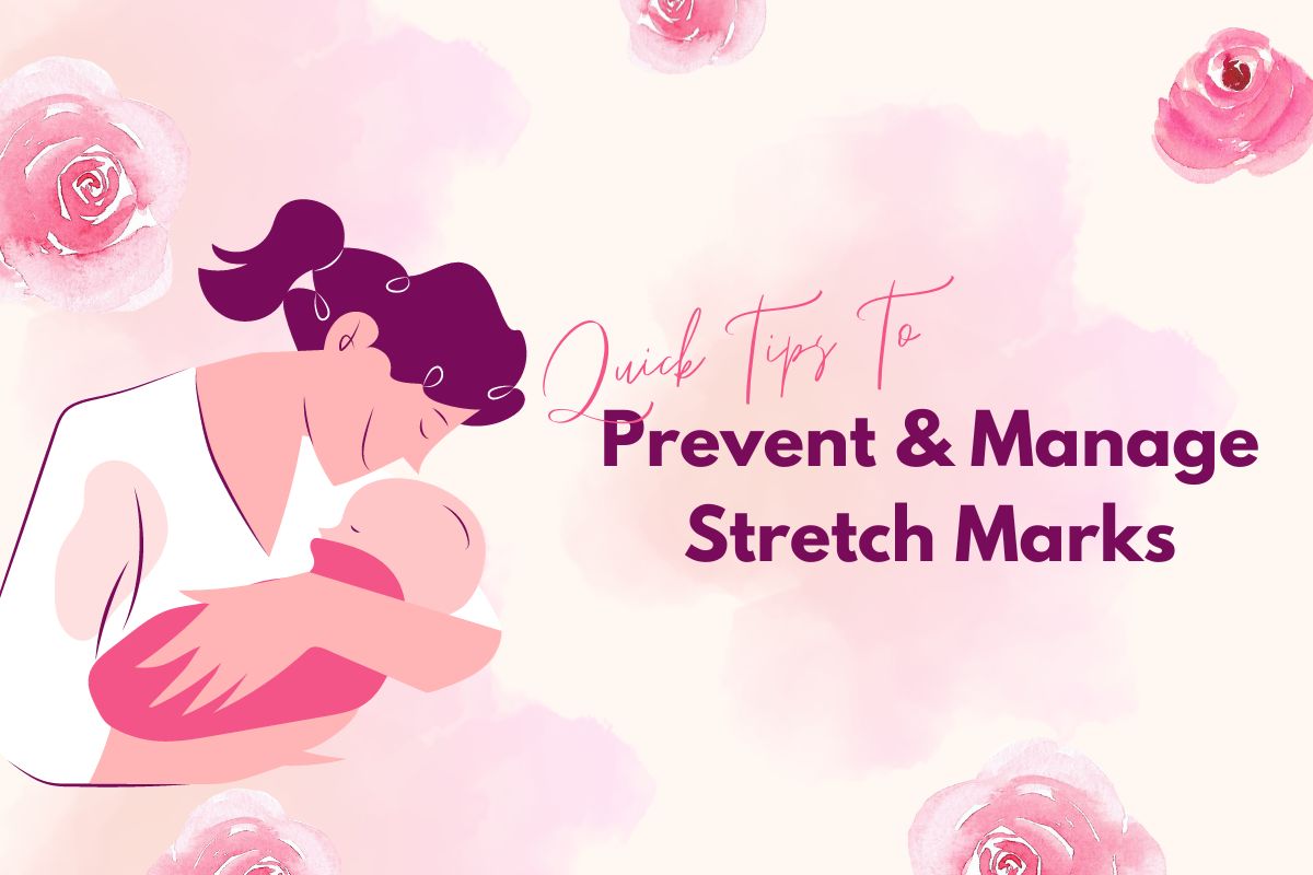 Quick Tips To Help Prevent and Manage Stretch Marks