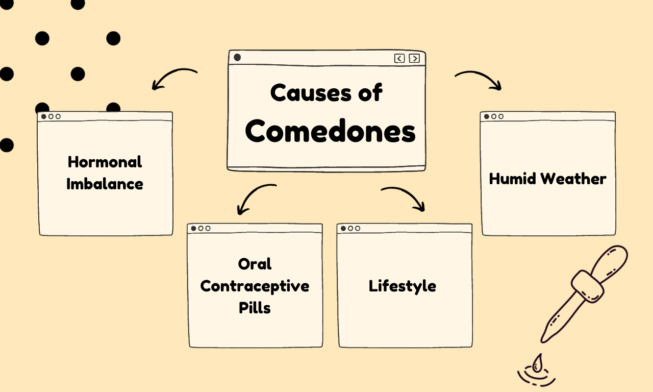 causes of comedones