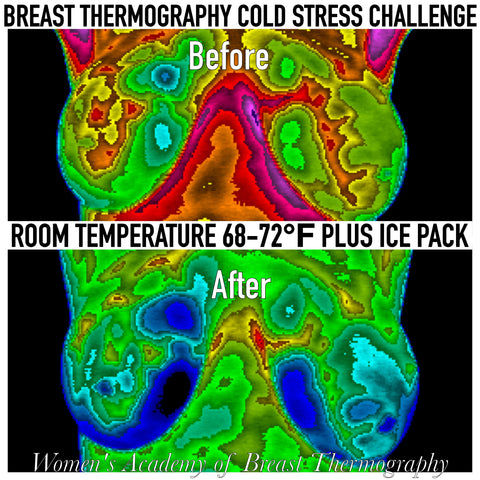 Two Ways Bras Affect Our Breast Health - The Thermogram Center