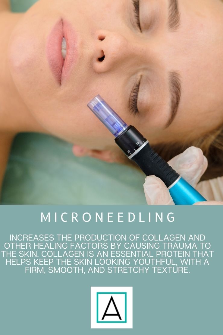 microneedling-skin-care-tip-anavita