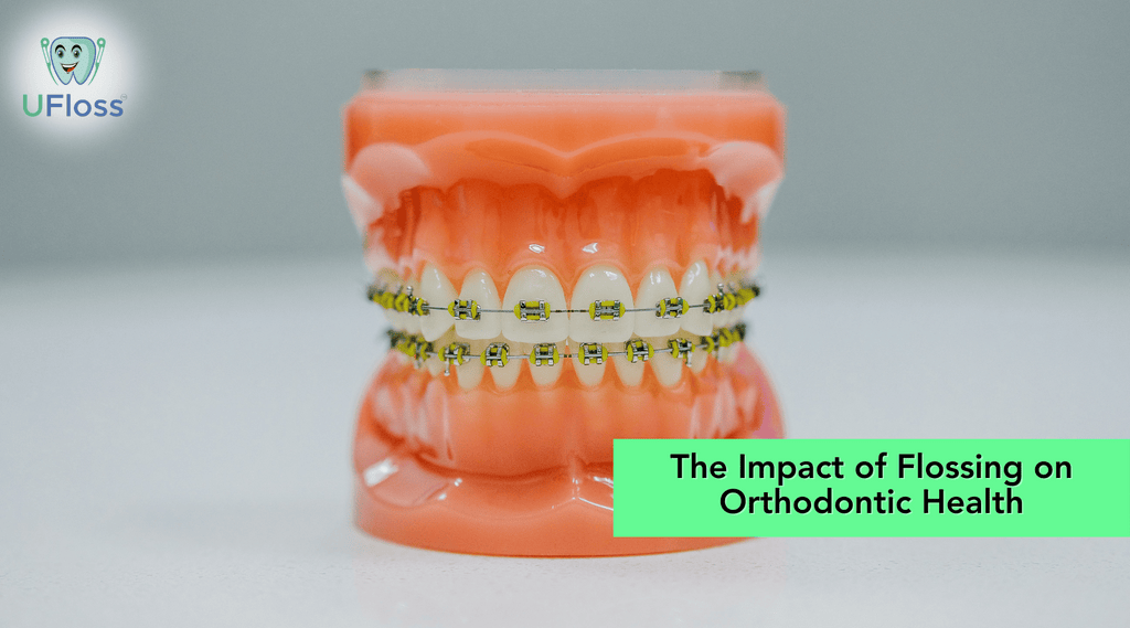 Model upper and lower teeth with braces and UFloss logo in upper right corner