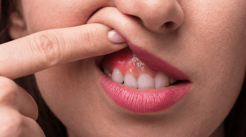 Young woman pulling back her upper lip to show red irritation and early gum disease