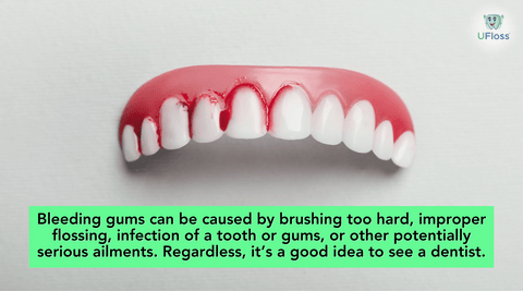 Model of upper human teeth with bleeding gums and factoid about gum health by UFloss oral hygiene company