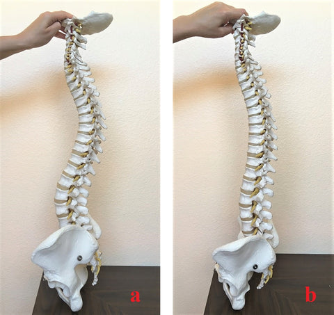 j shaped spine