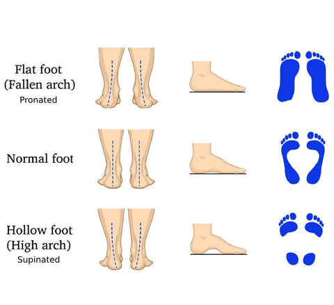 pronation vs supination