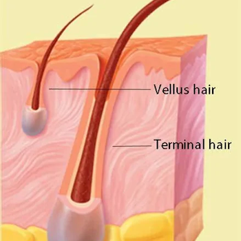 vellus hair vs terminal hair