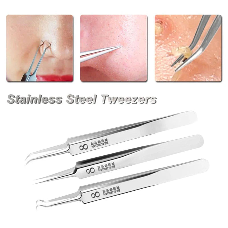 "Blackhead remover tool" "Acne treatment tools" "High-precision tweezers" "Stainless steel tweezers" "Blackhead extraction tool" "Professional facial tools""Health""Acne"