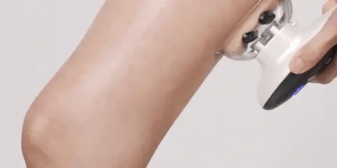 EMS Vacuum Suction Cup Massager Targeted Cellulite Reduction - SmartFusion