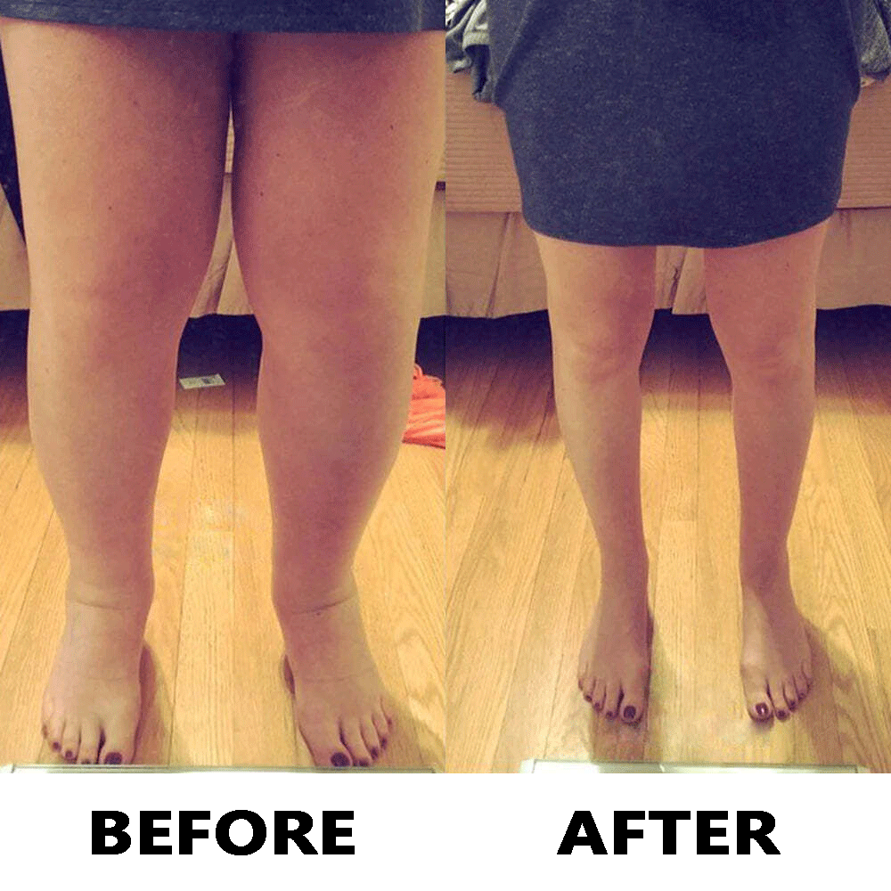 before and after image