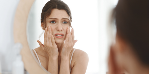 stress acne and how to prevent it