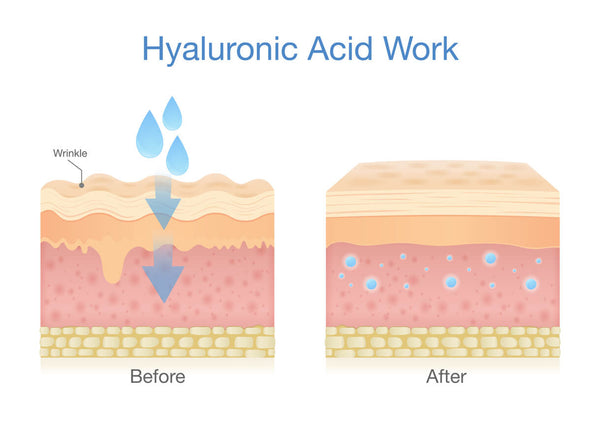 Illustration of hyaluronic acid's ability to retain moisture.