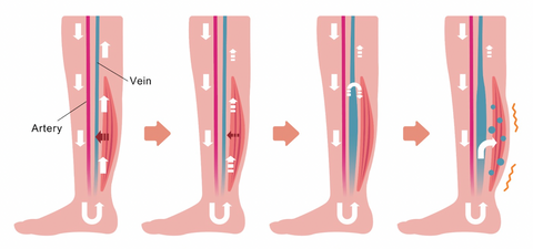 Anti-Swelling High Arch Support Insoles