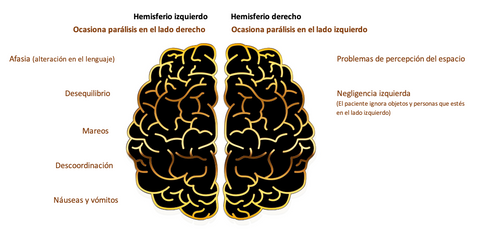 ¿Cuánto tiempo se tarda en recuperarse de un ictus?