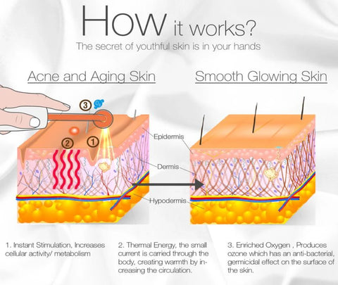 how does high frequency wand work