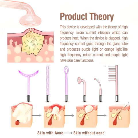 how do the high frequency wand work