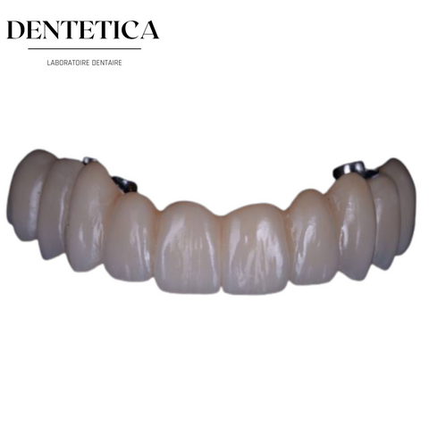 Dentier en zircone