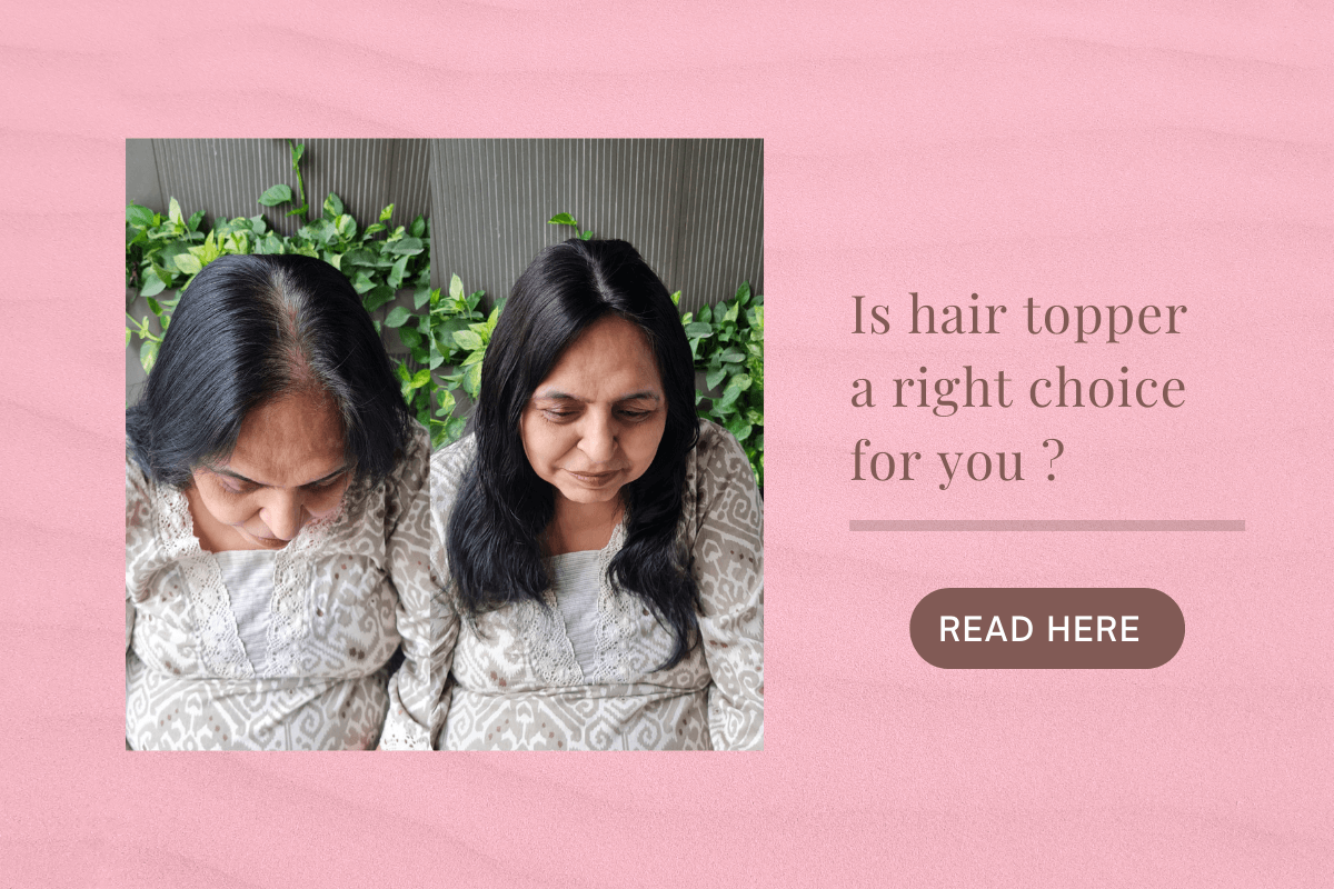 hair patch online