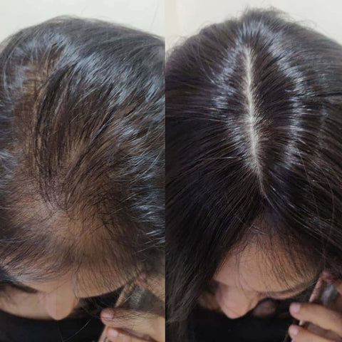 DermMatch Hair Loss Concealer  Great For Thin Hair Or Small Bald Spots