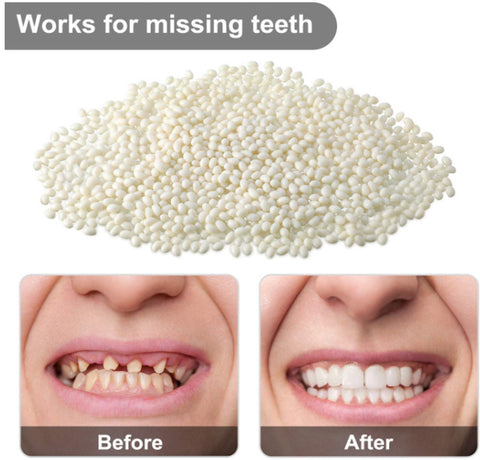 Temporary Broken Teeth Repair Kit, Moldable False Bangladesh
