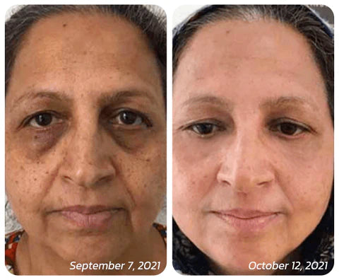 HealthX™ Lotus Essence Natural Anti-Wrinkle Acne & Scar Removal Serum