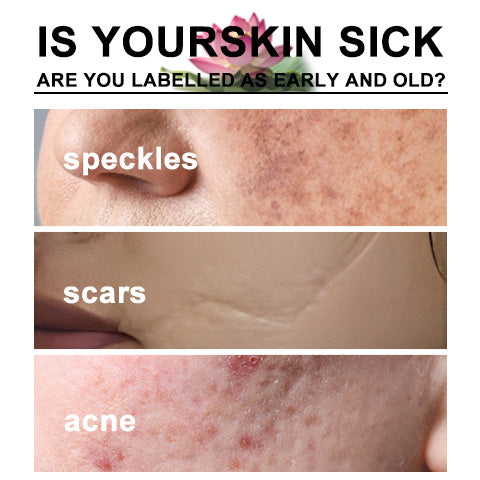 HealthX™ Lotus Essence Natural Anti-Wrinkle Acne & Scar Removal Serum